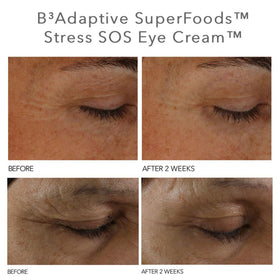 Dr Dennis Gross SOS eye cream (5ml)